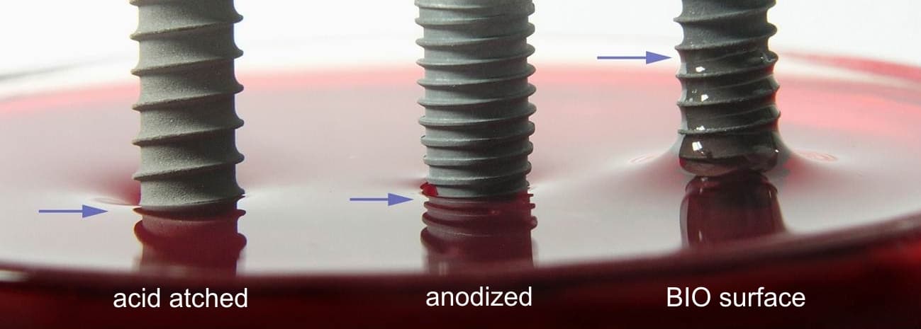 Vergleich der Benetzung mit Blut: acid etched, anodized und BIO-Oberfläche