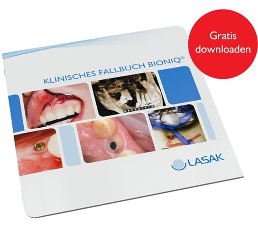 Klinisches Fallbuch BioniQ von LASAK